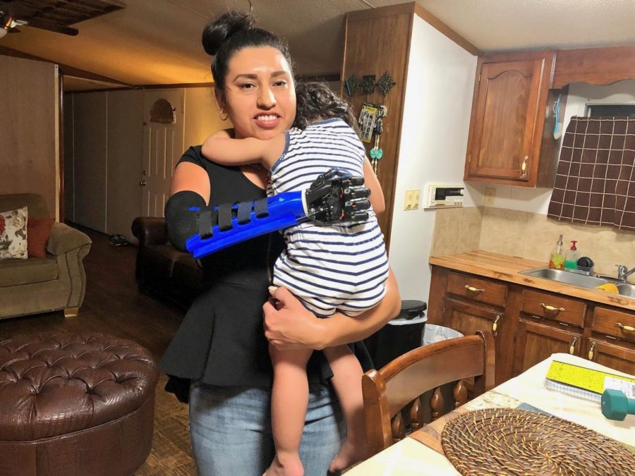 Vanesa del Rosario Castellon pictured with her kid and the prosthetic hand.